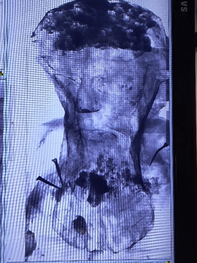 Escultura São Jerônimo sendo preparada para tomografia no HU/USP