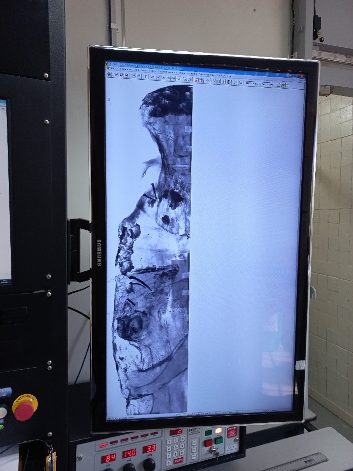 Escultura São Jerônimo sendo preparada para tomografia no HU/USP