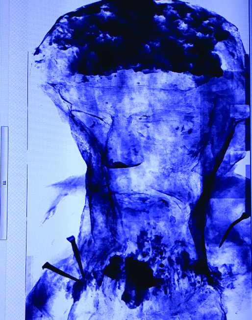 Foto do detalhe da obra em raio-x